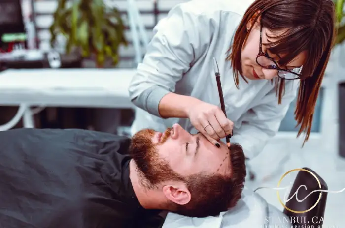 تقنيات زراعة الشعر في Istanbul Care