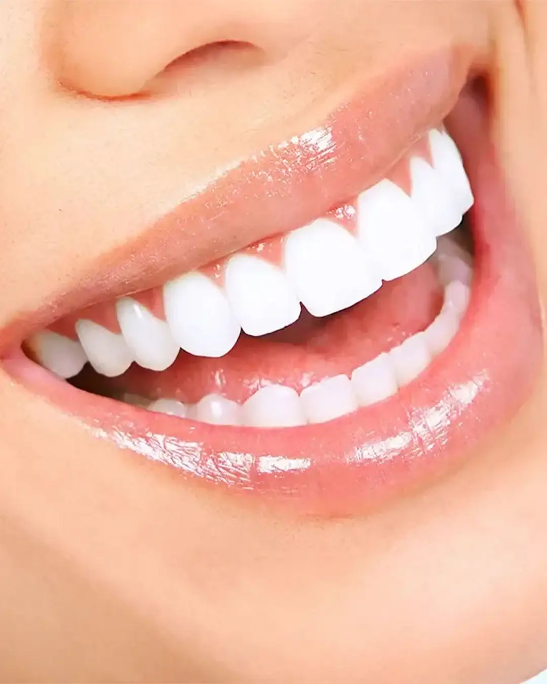 Primer plano de una sonrisa radiante con dientes blancos perfectos.