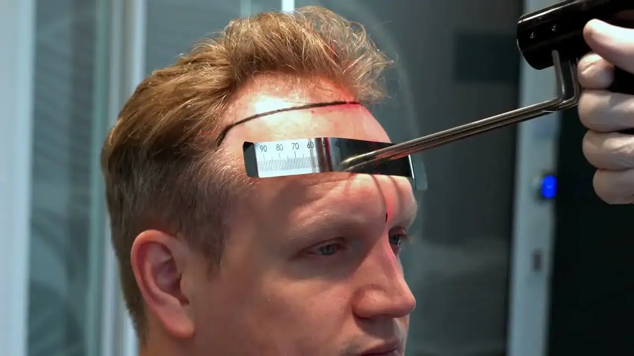 Hair Transplant Videos