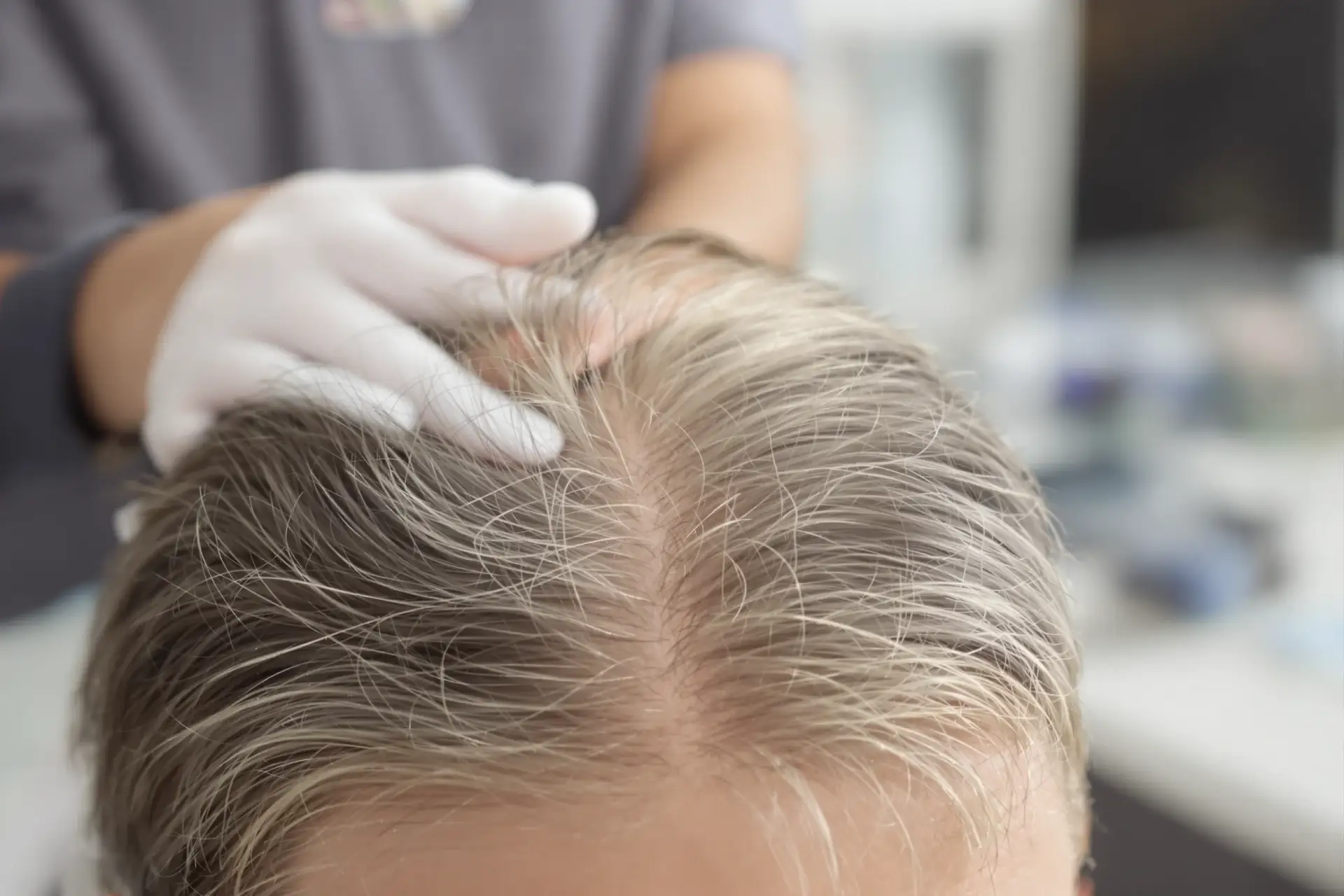 Cabelo com Redemoinho: O Que Causa e Como Corrigir