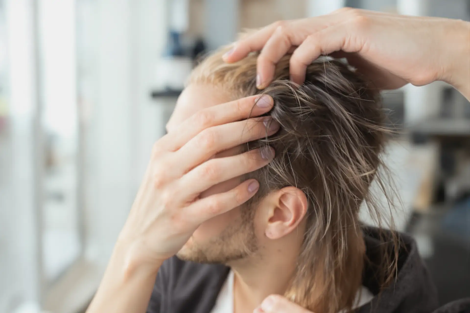 DHT and Hair Loss: Frequently Asked Questions