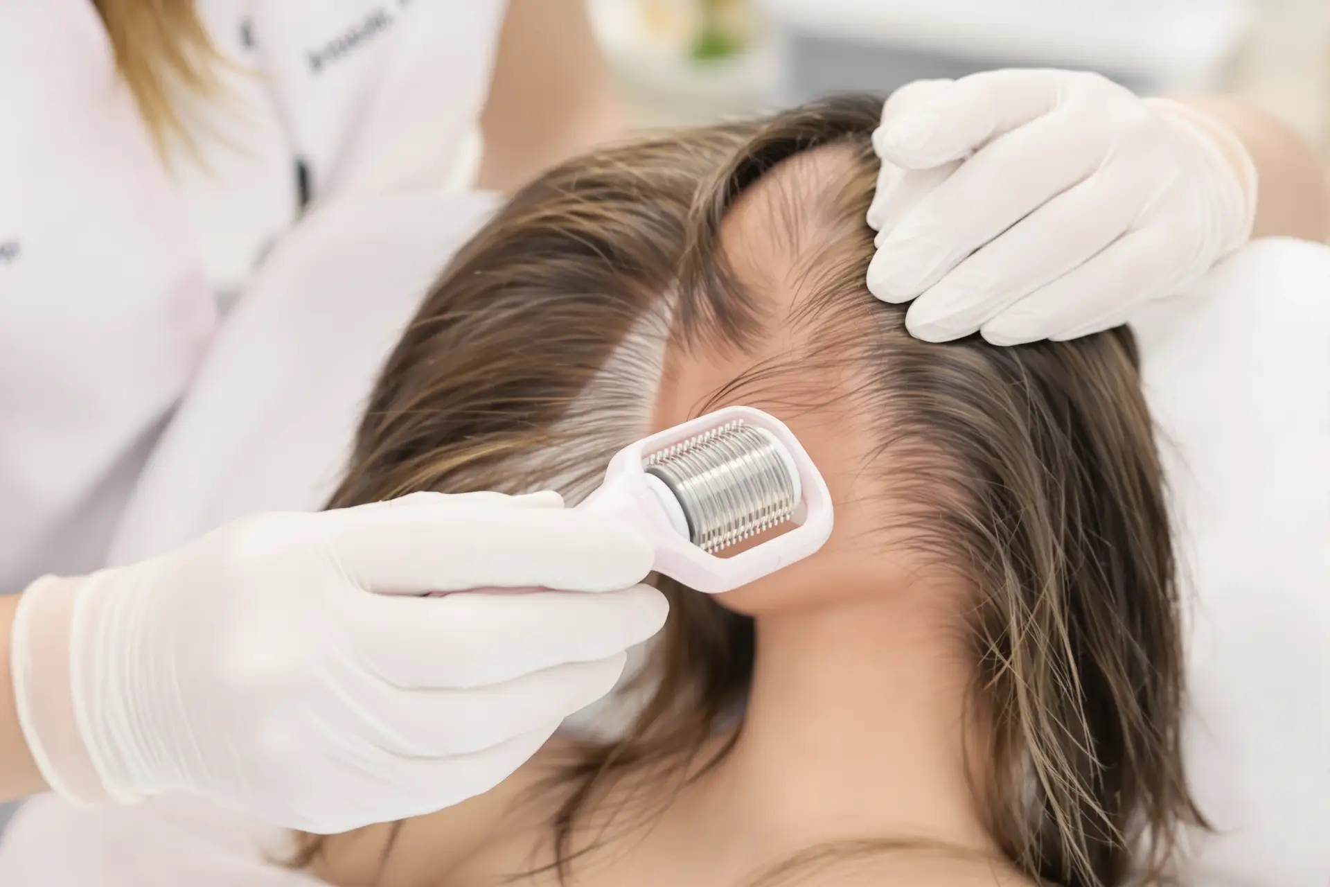 Derma Roller for Hair Growth: Answers to FAQs