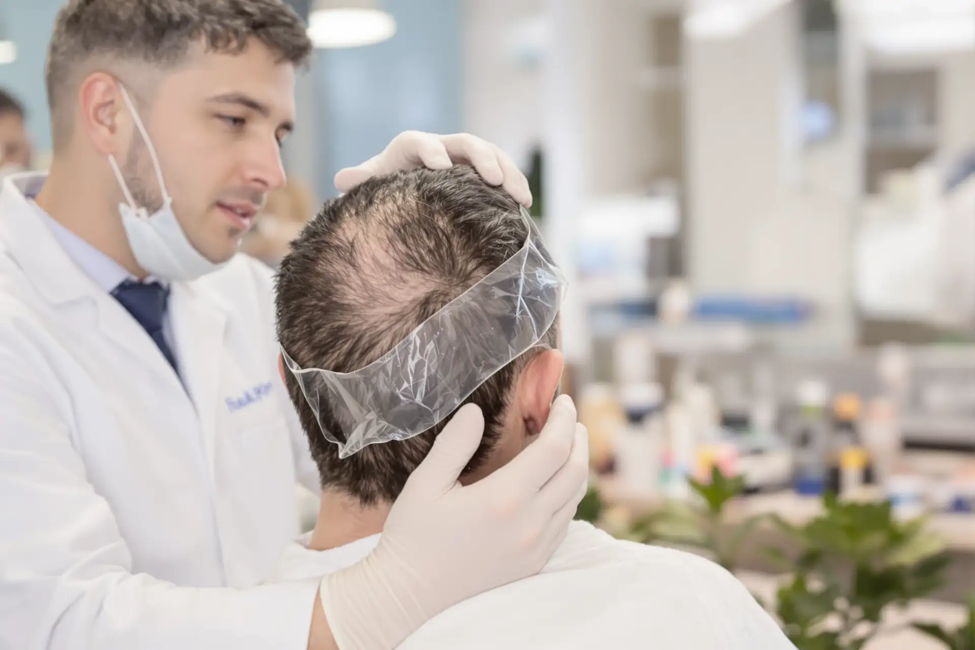 Custo do Transplante Capilar na Turquia Explicado