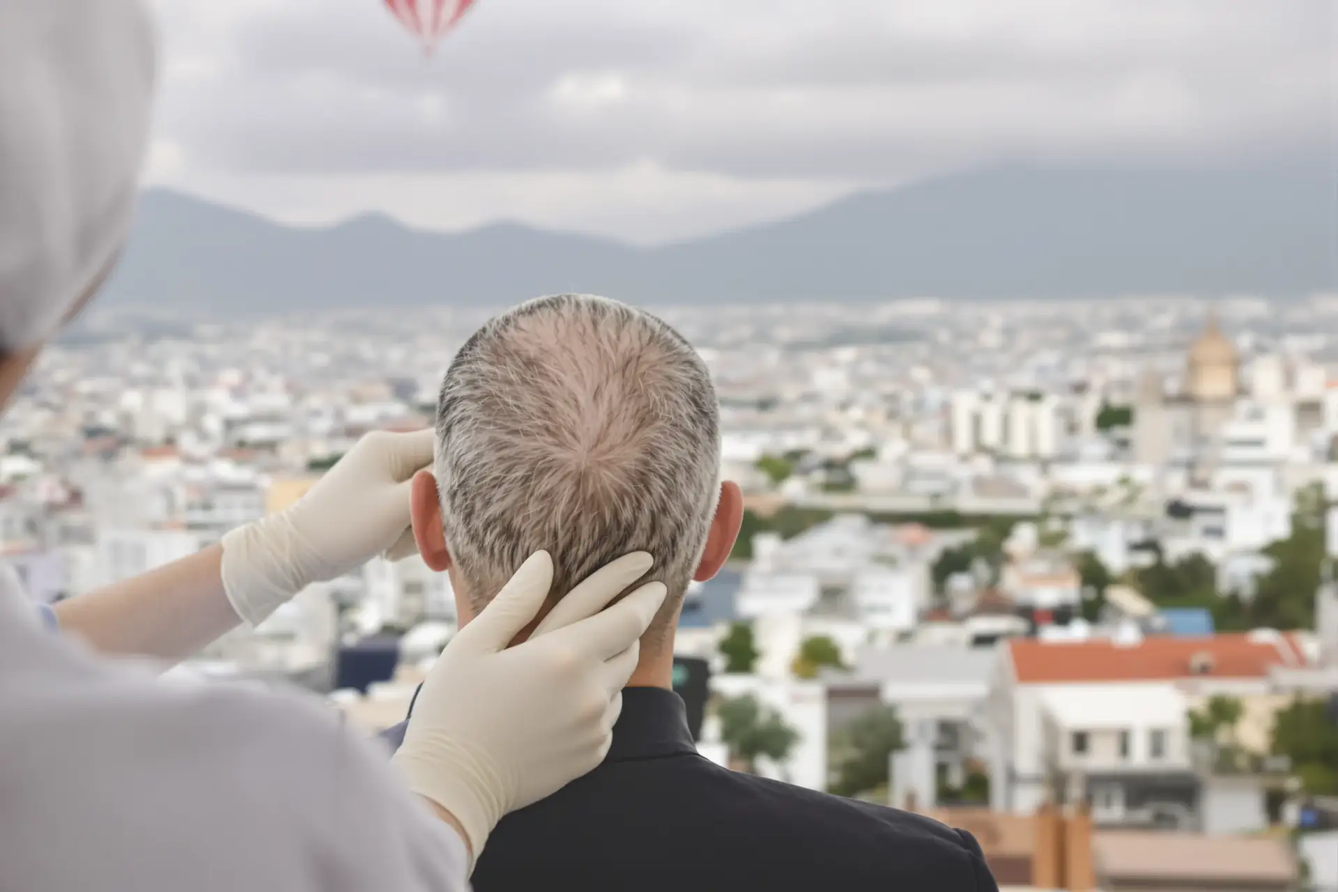 زراعة الشعر في ألبانيا: حقائق أساسية