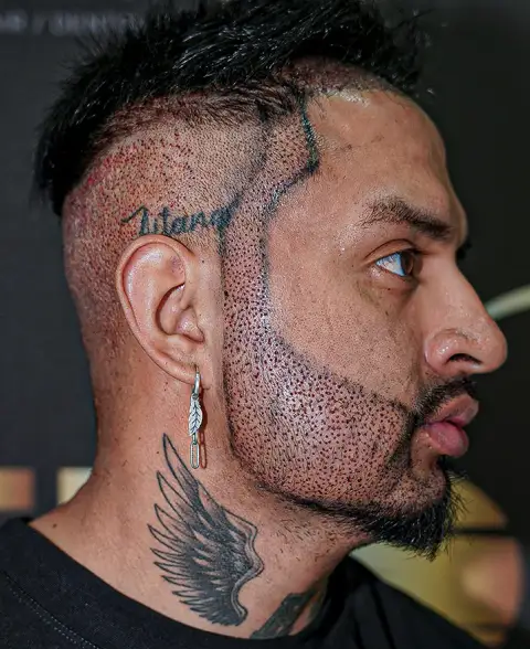 donor-hair-options-from-scalp.jpg