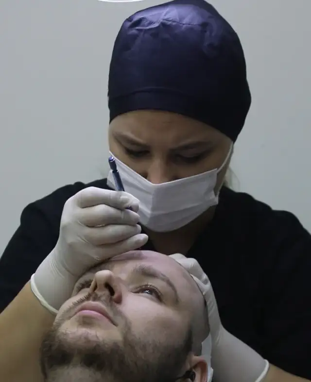 Surgical team implanting grafts during a hair transplant