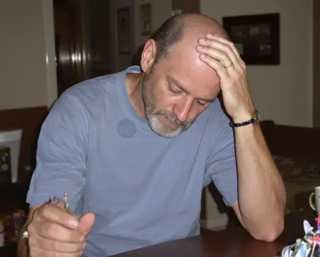 Man with advanced hair loss across the front and crown