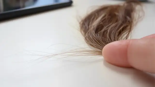 رسم توضيحي عام. ليست صورة لريموند فان بارنيفيلد وليست دليلاً على أي إجراء.
