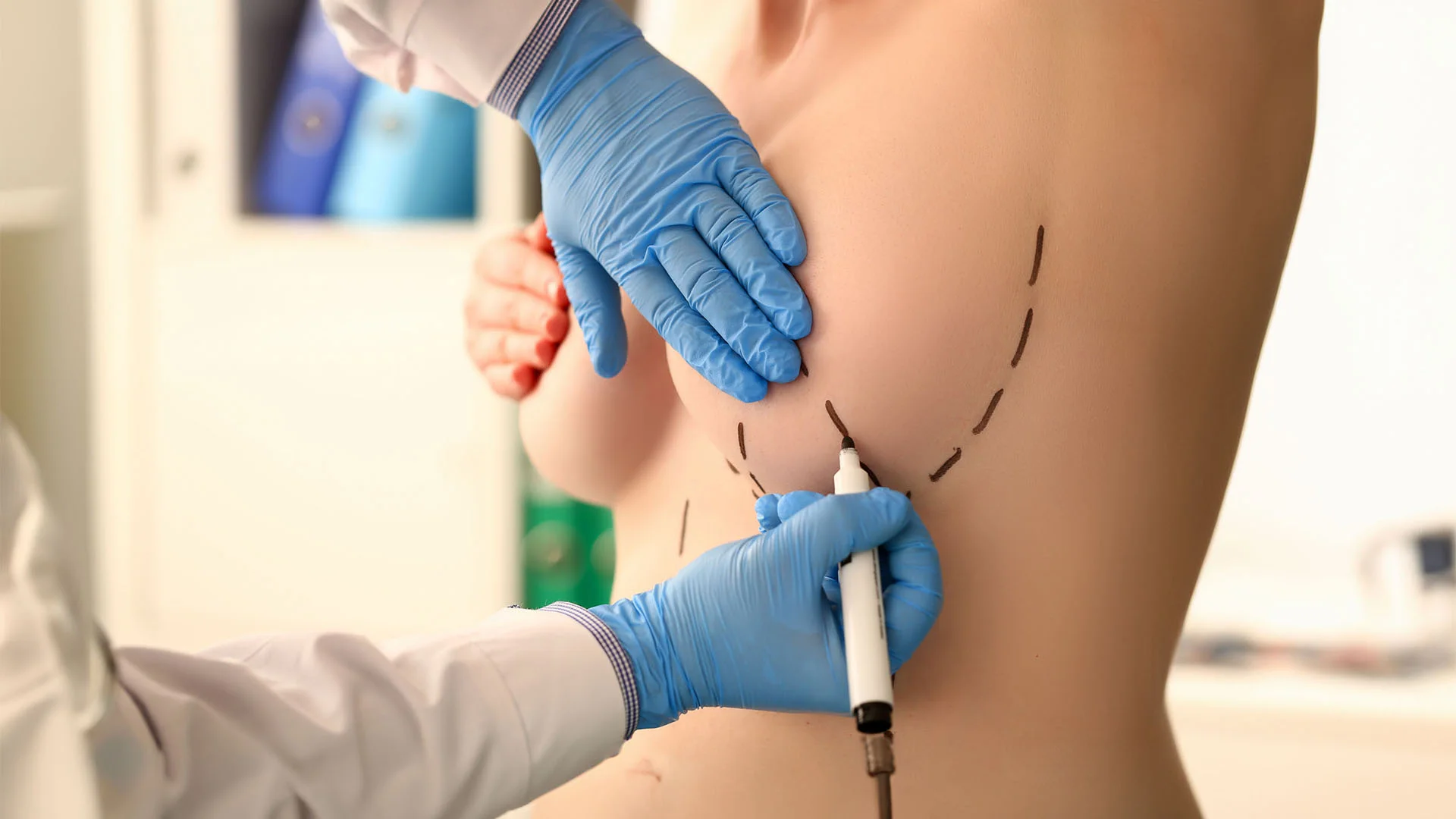 Reduktimi i gjoksit në Kujdesin e Stambollit