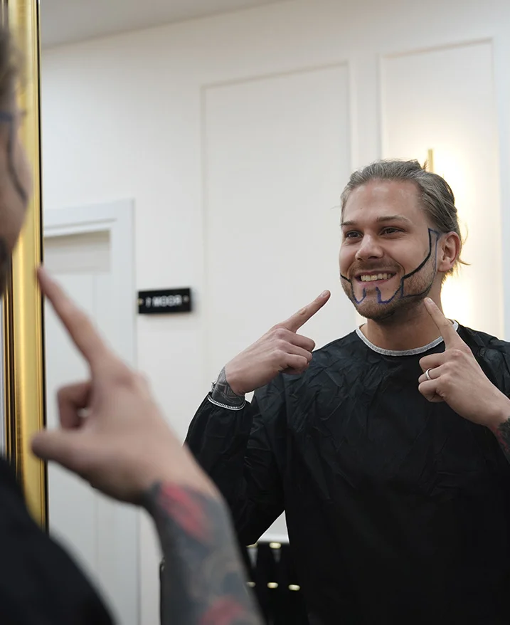 Technique de greffe de poils de barbe