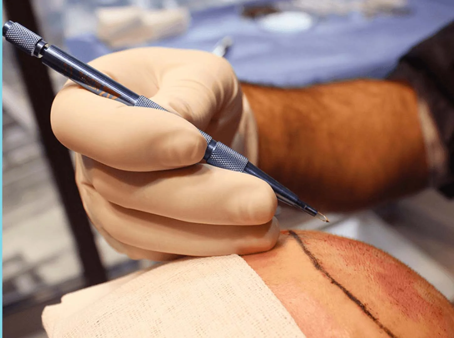 Coste y planificación de su tratamiento fue de zafiro