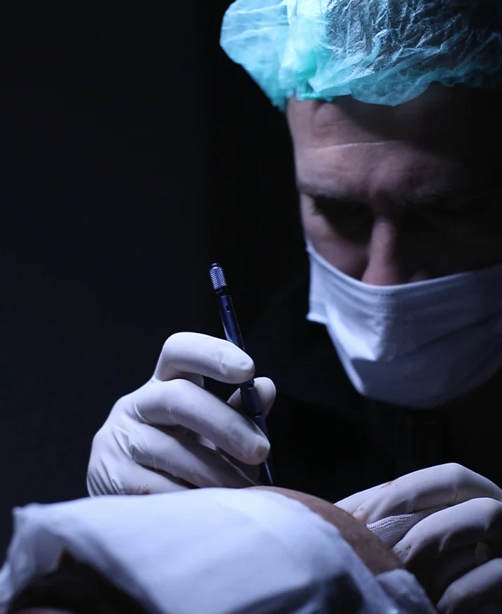 Schnellere Heilung mit der Saphir-FUE-Technik