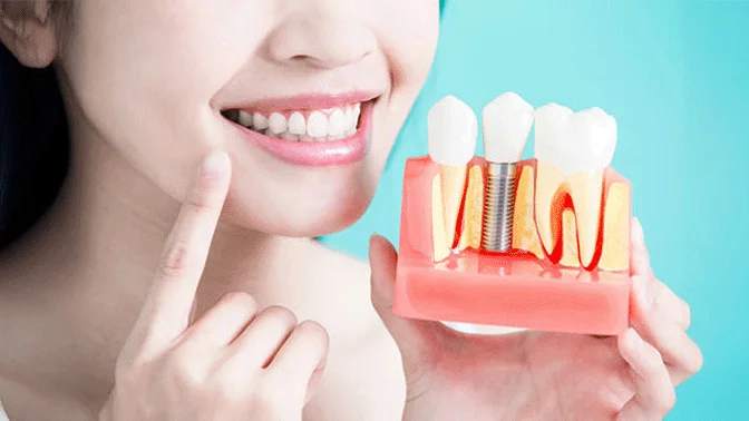 Vindecare după intervenția chirurgicală a implantului dentar