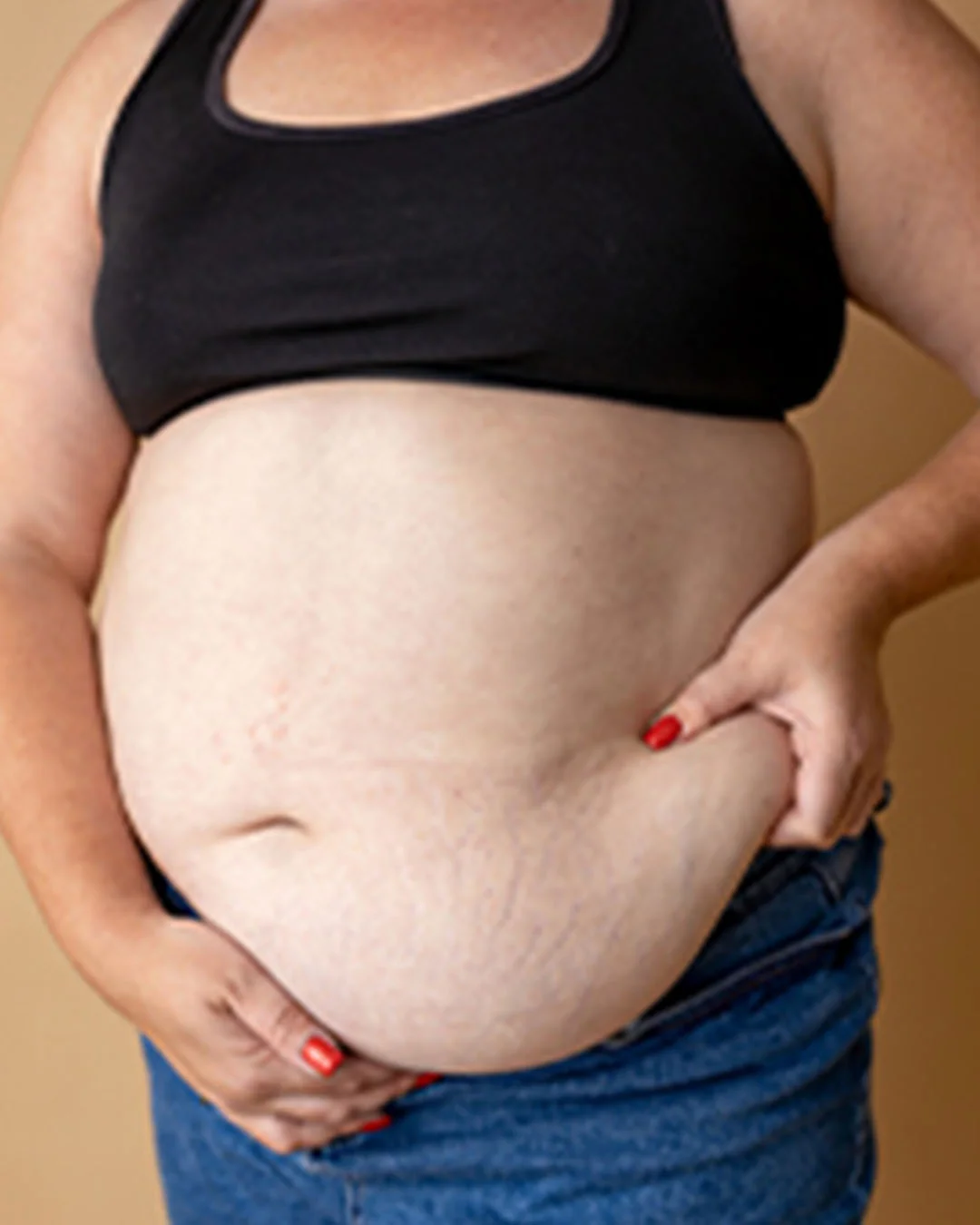 Wie hilft die Magenbandage den Patienten, Gewicht zu verlieren?