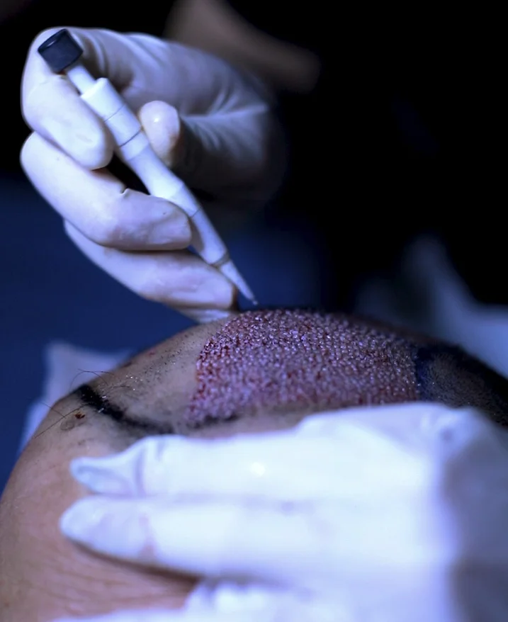 Geringes Infektions- oder Blutungsrisiko