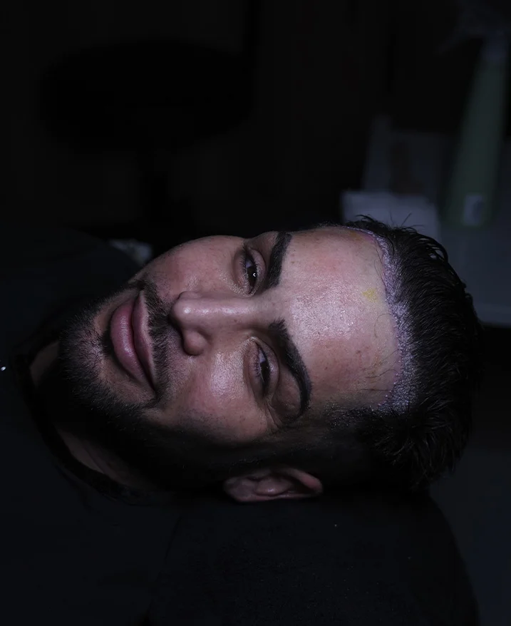 Reduzierung von Narbenbildung und Blutungen sowie Verbesserung der Heilung