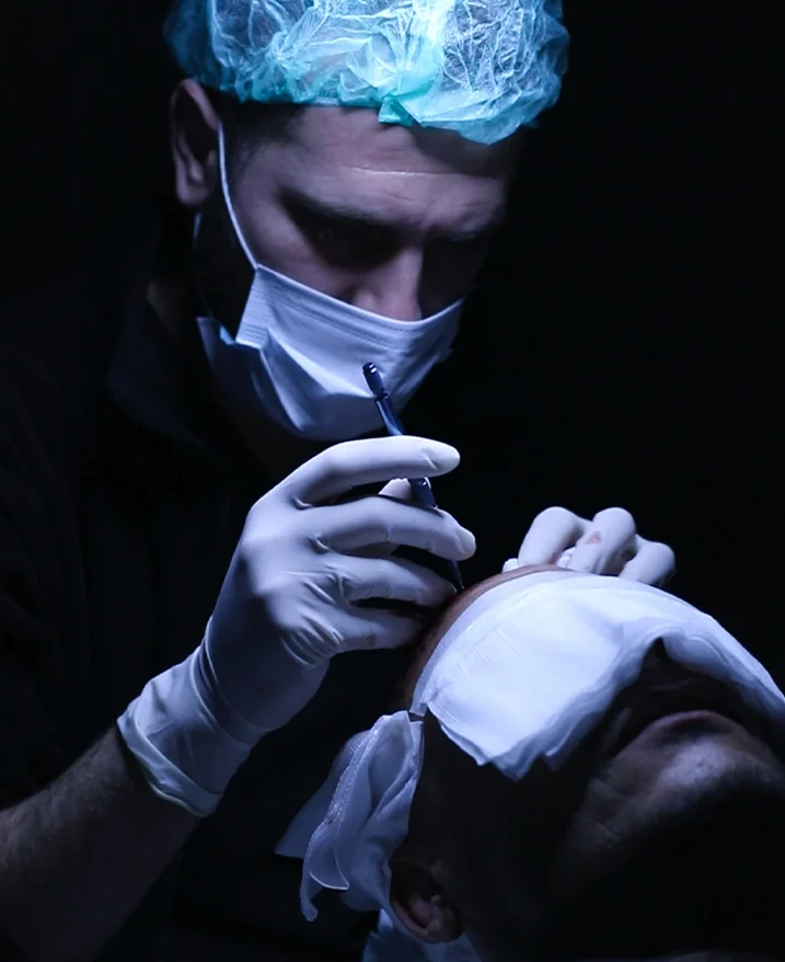 Saphir FUE Haartransplantation in der Türkei