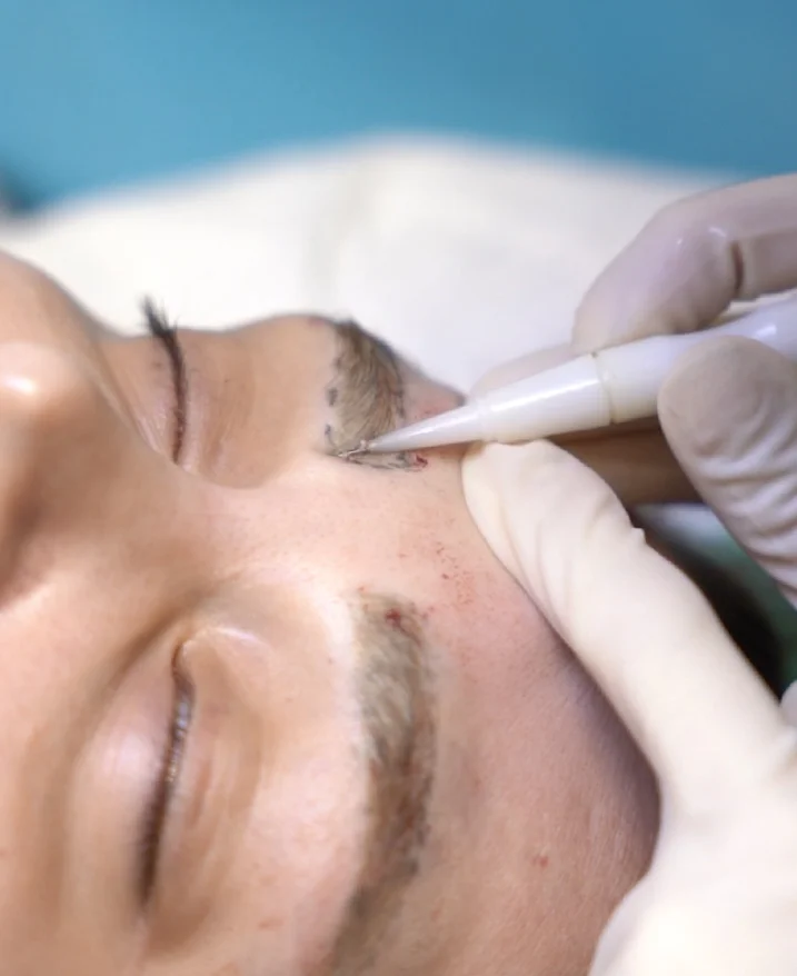 Rozwiązania dla nadmiernie wyplączonych lub cienkich brwi