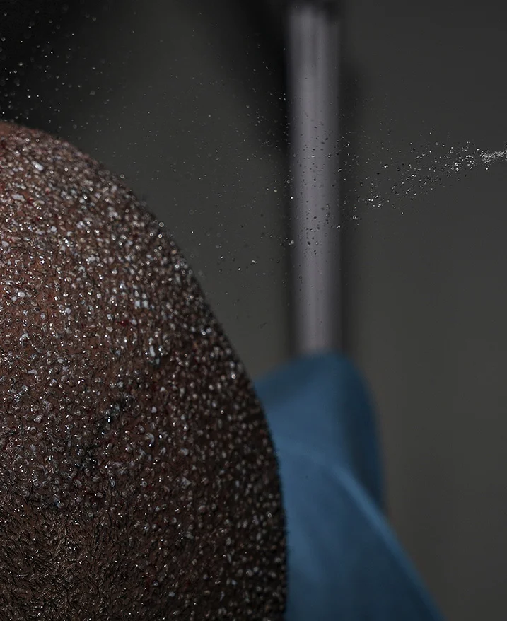 Kuptimi i Ekstraksionit të Njësive Folikulare dhe si funksionon