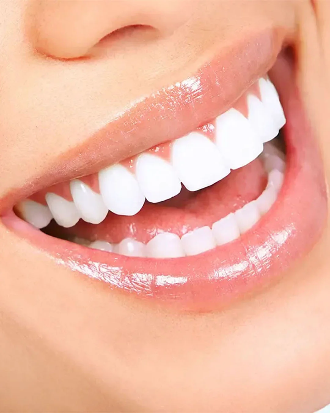 O Processo de Tratamento de Folheado