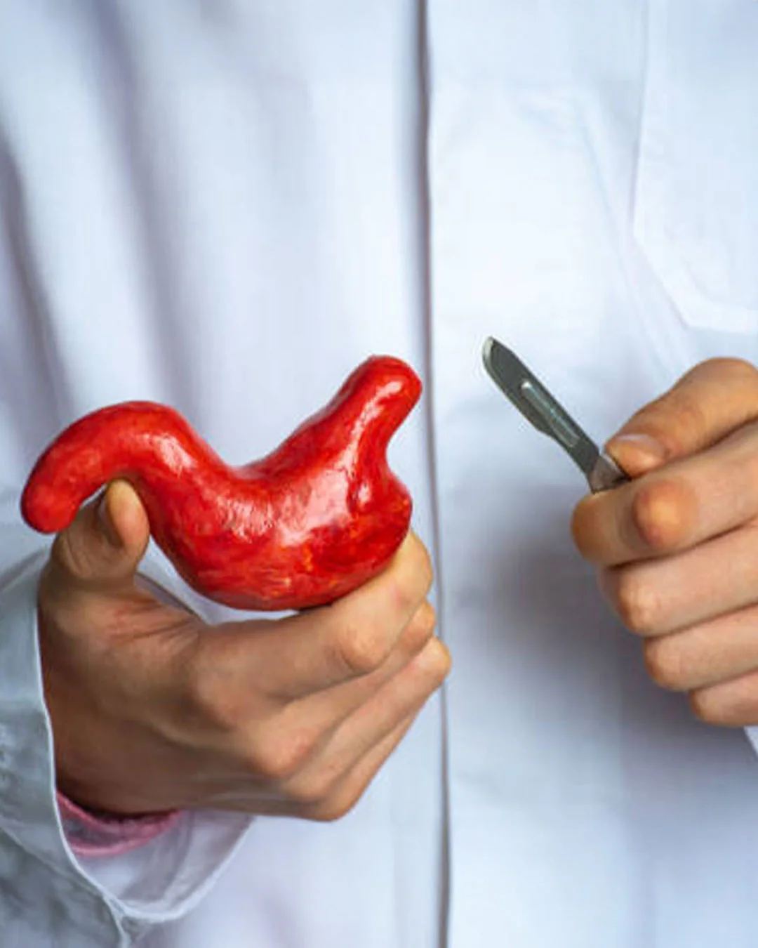 Was sind die Nebenwirkungen einer Magenbypass-Operation?