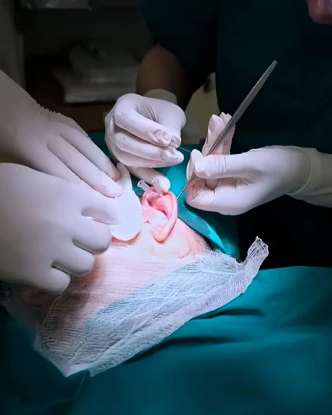 Was Sie bei einer Otoplastik-Beratung erwarten können