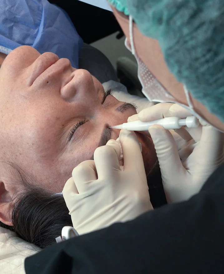 Kiedy nie zaleca się przeszczepu brwi