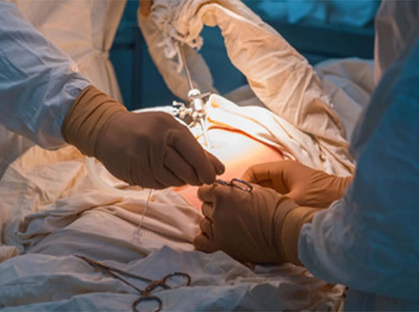 Wer kann sich einer Magenbypass-Operation unterziehen?