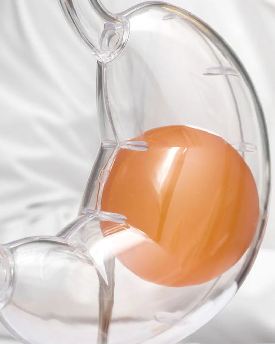 Kush është kandidat për tullumbacen gastrike?