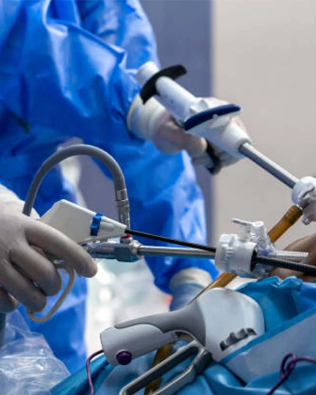 Wer qualifiziert sich für eine LAP-BAND-Operation?