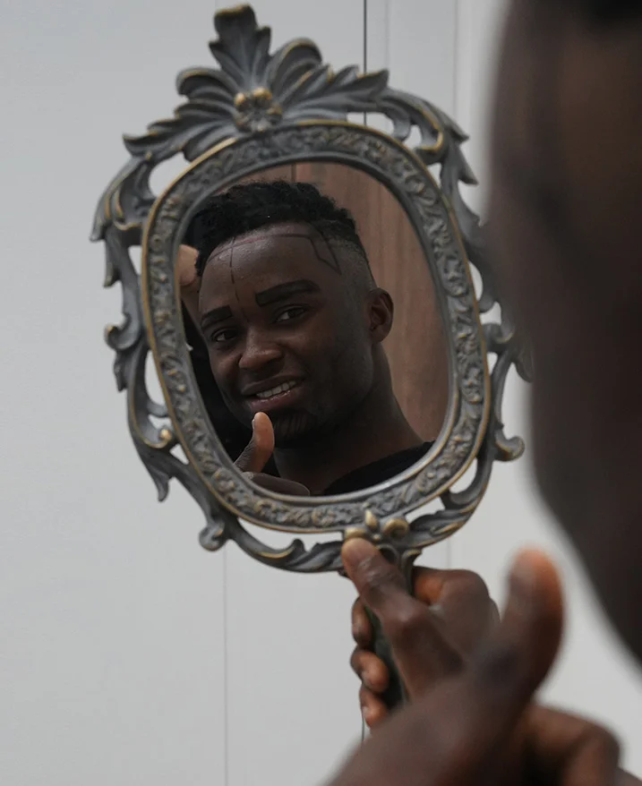 Trasplante de cabello afro en Turquía