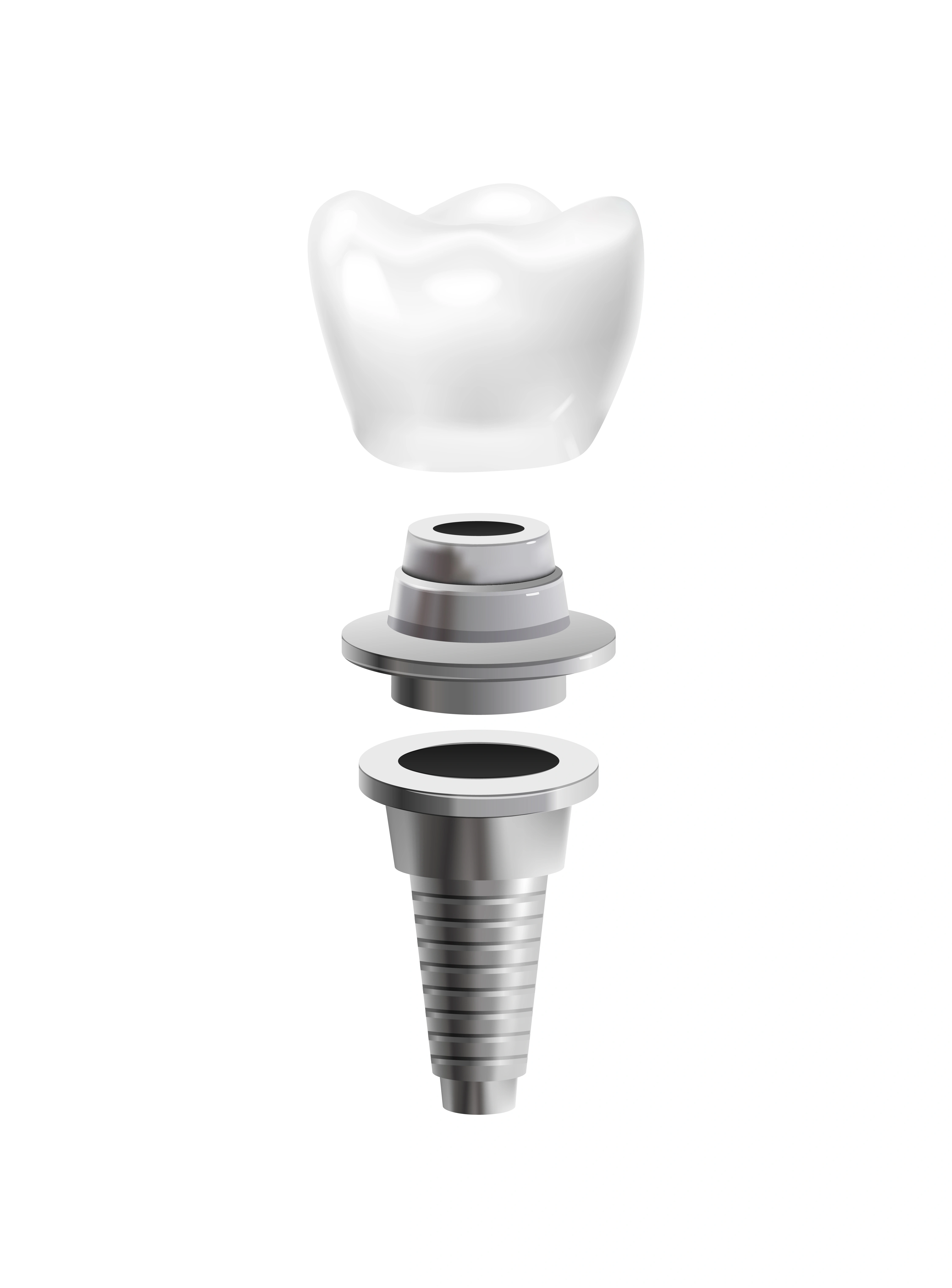 all-on-8-dental-implants