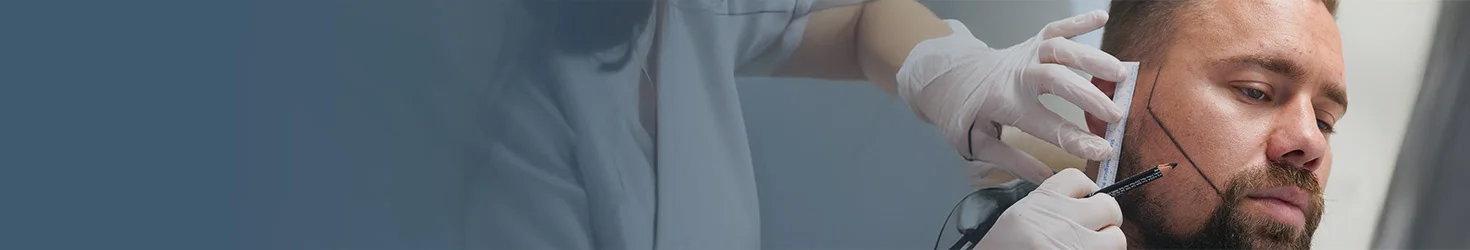 Greffe de barbe en Turquie