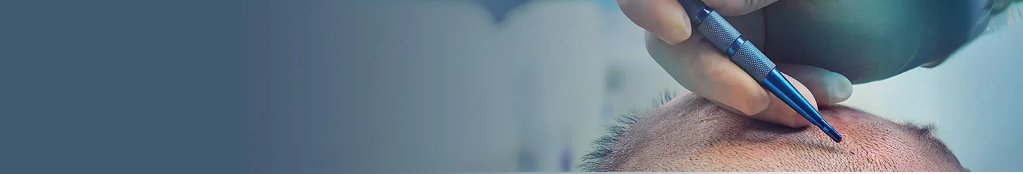 Sapphire FUE-Haartransplantation