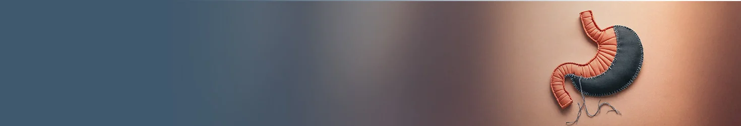 Gastrektomia rękawowa w Turcji