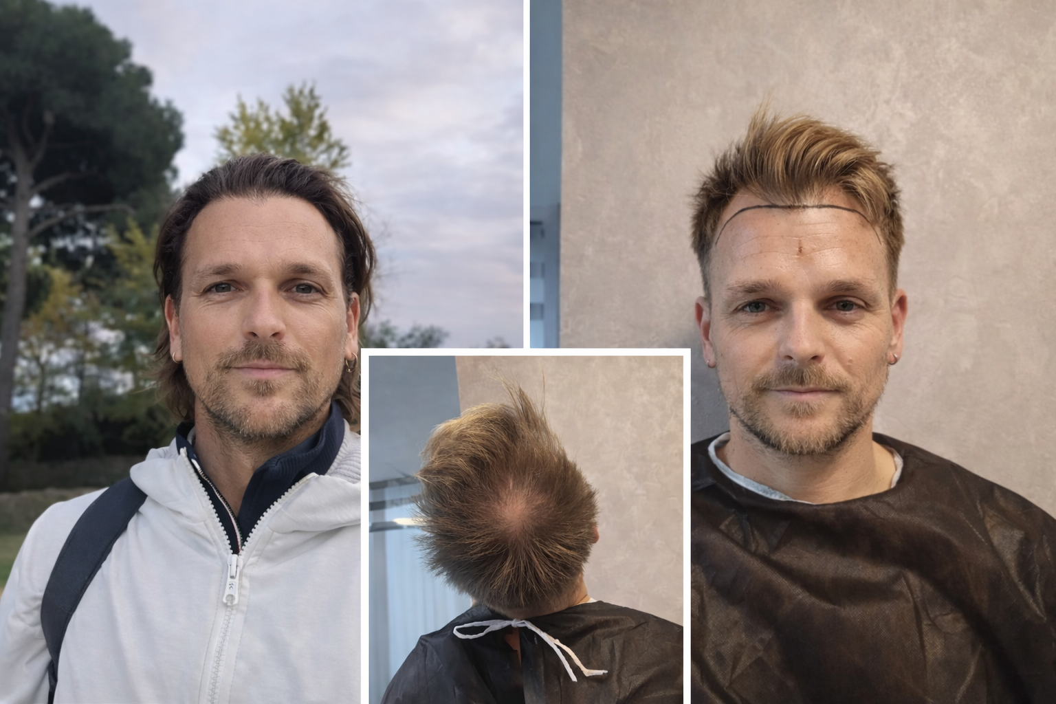 istanbul care case study