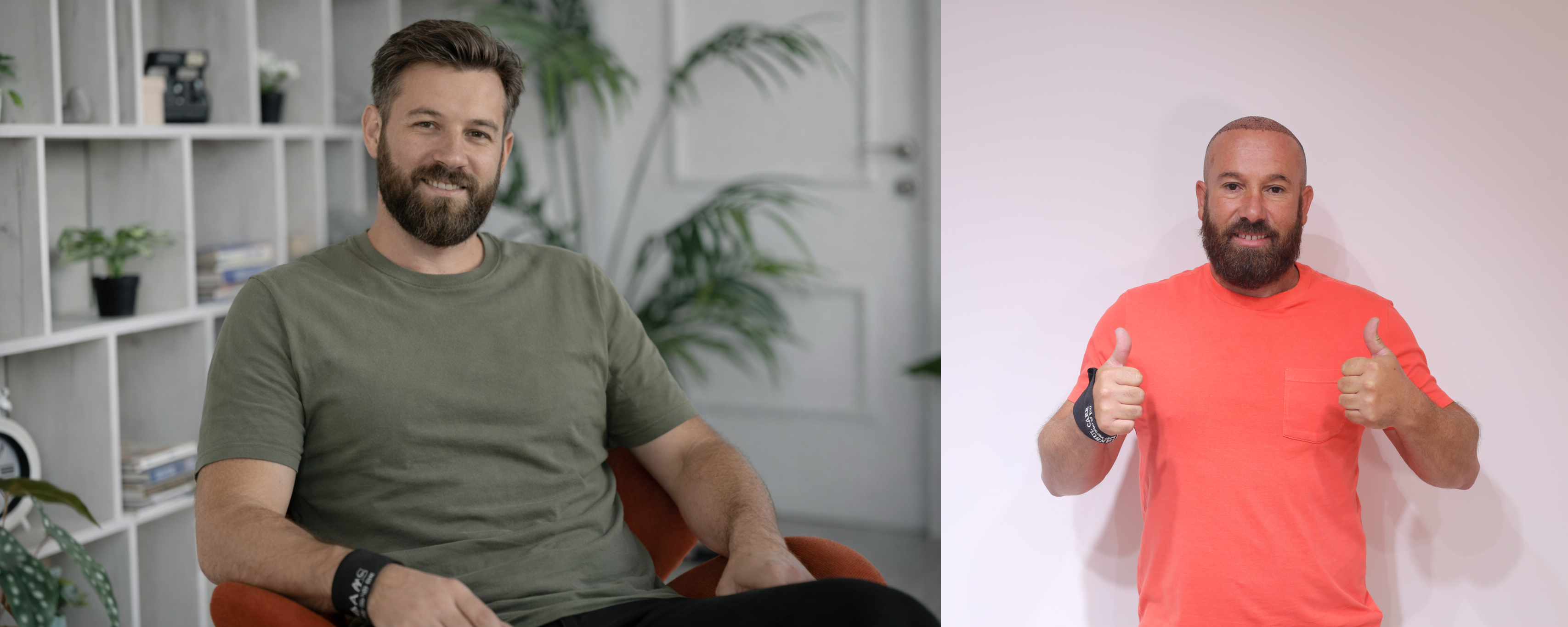 hair transplant patient before after