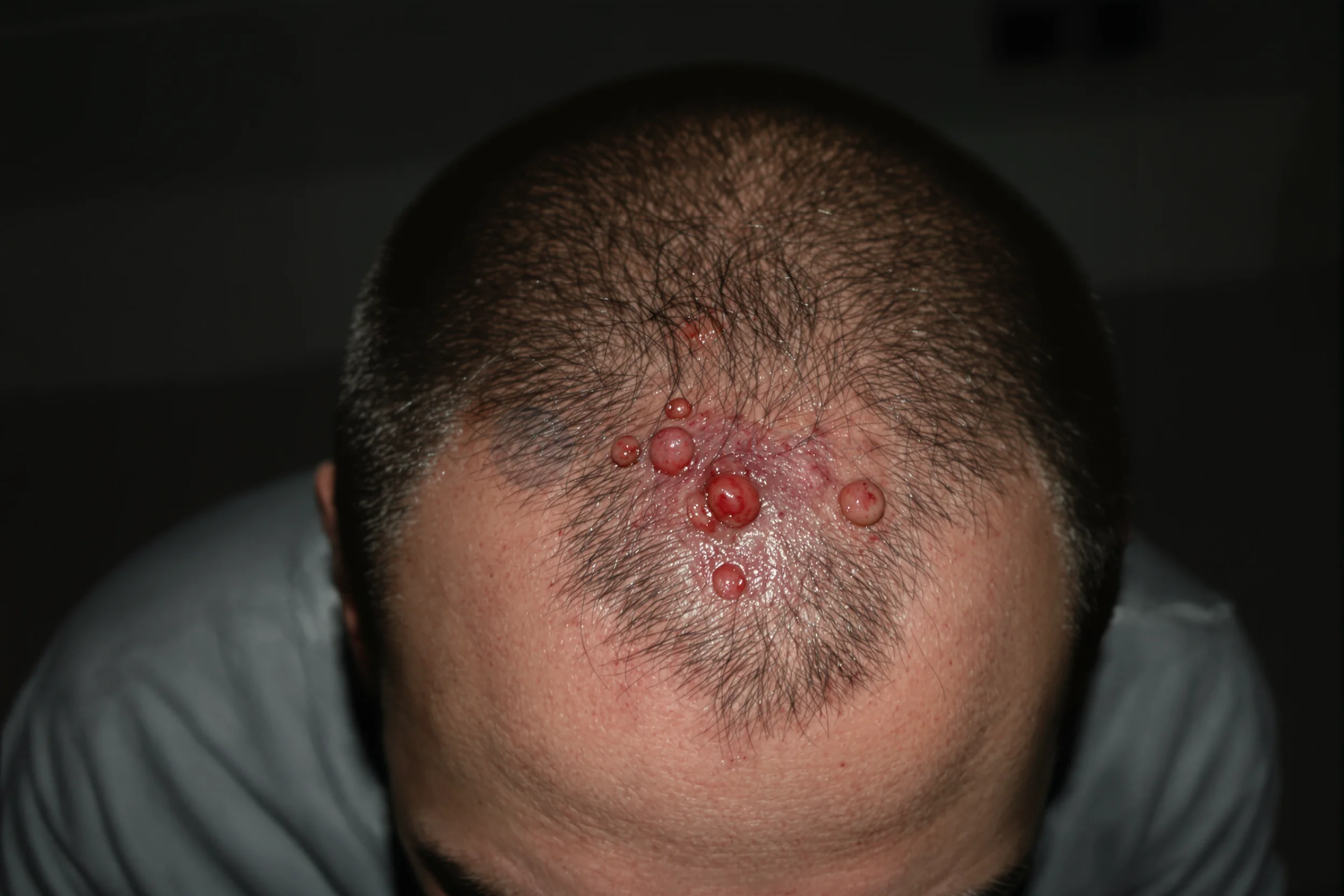 Conoscere l'équipe, Organizzare il soggiorno — Orientarsi prima di un trapianto di capelli in Turchia Conoscere l'équipe, Organizzare il soggiorno — Orientarsi prima di un trapianto di capelli in Turchia – featured image from Istanbul Care