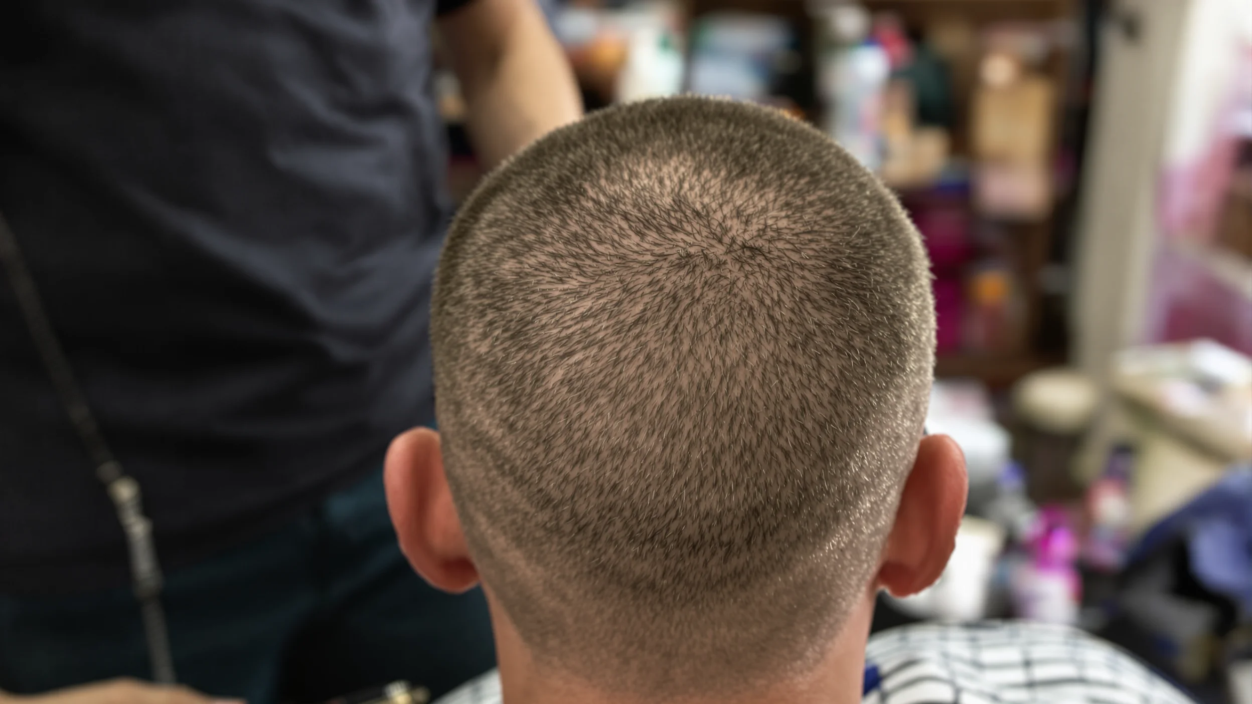 Ilustración genérica de archivo: la parte posterior de una cabeza anónima con cabello corto y rapado. No es una fotografía de ninguna persona nombrada ni un resultado de antes y después.
