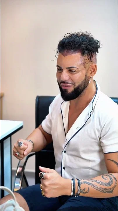 Still frame from the Istanbul Care video on the complete hair transplant process in Istanbul: a bearded patient with tattooed arms sits in the clinic chair, his hairline shaved and marked in purple before the procedure.