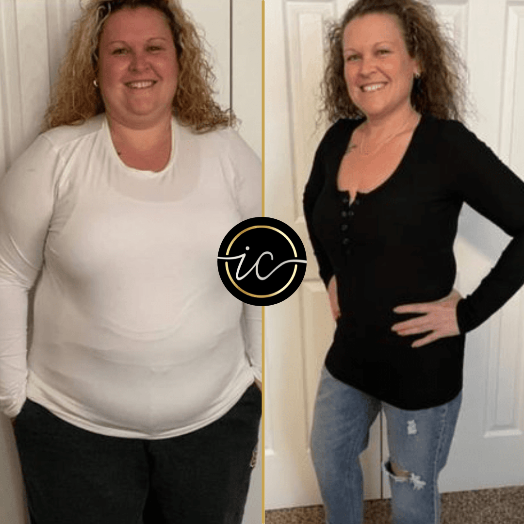 Gastric Balloon Turkey Before & After