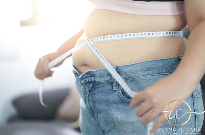 gastric-bypass-turkey-surgery