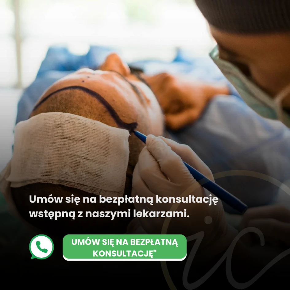 skorzystaj z bezpłatnej konsultacji przeszczep włosów