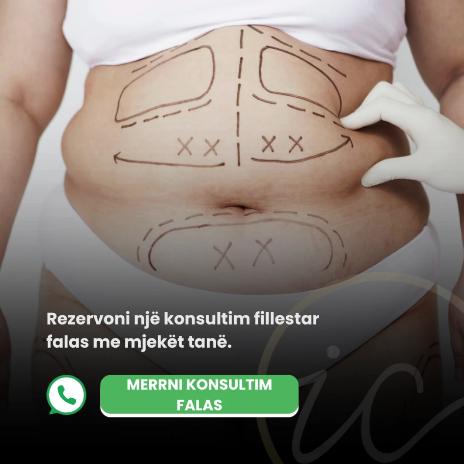 konsultohuni falas mega liposuction