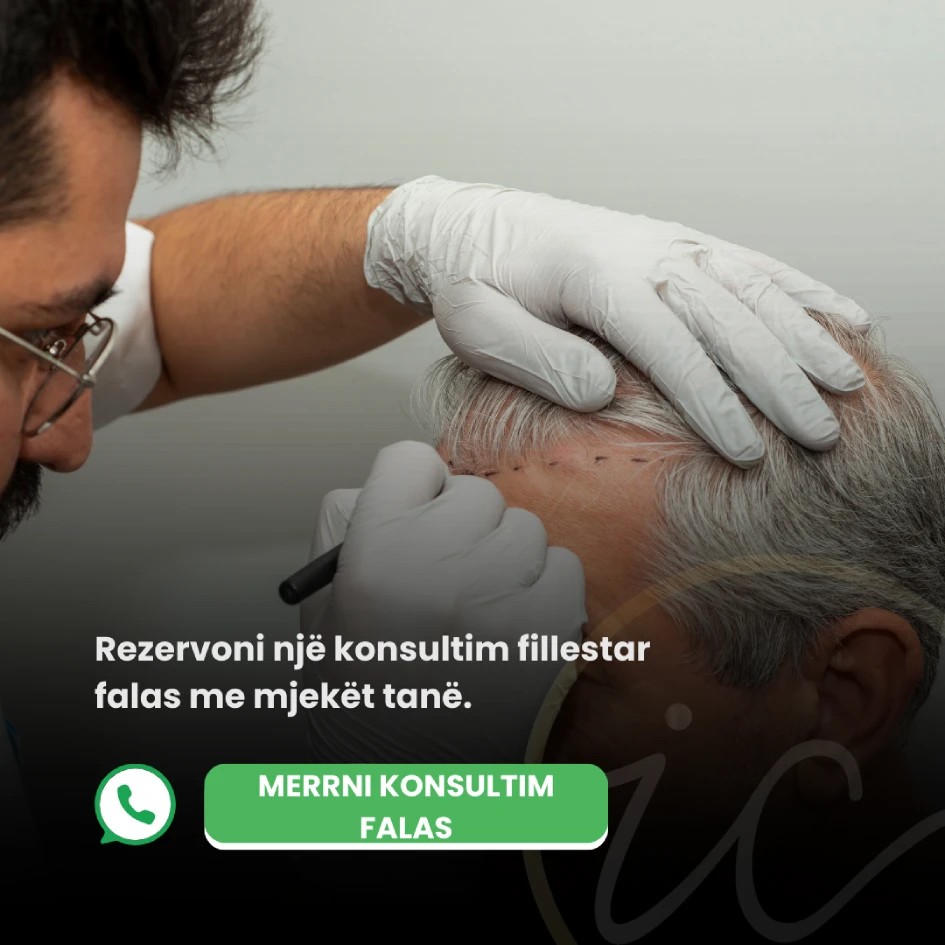 konsultohuni falas saphhire fue hair transplant