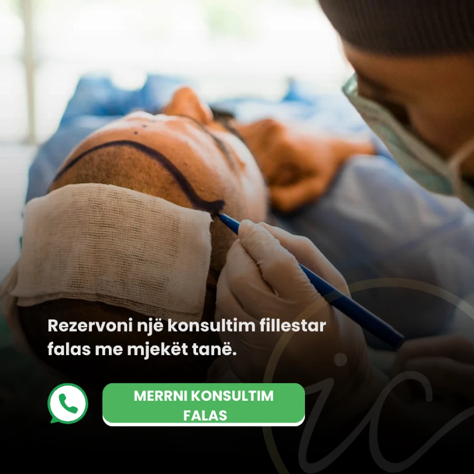 merrni konsultim falas transplantim flokësh