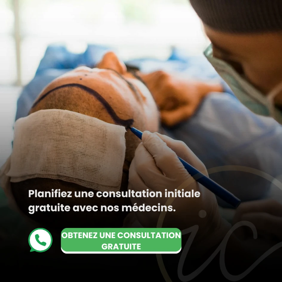 greffe de cheveux obtenez une consultation gratuite