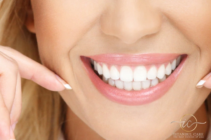 Caring for Your Hollywood Smile