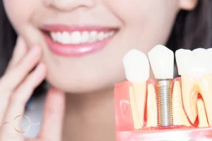 Healing Process After Dental Implants
