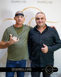 affordable-hair-transplant-turkey-for-spanish-men